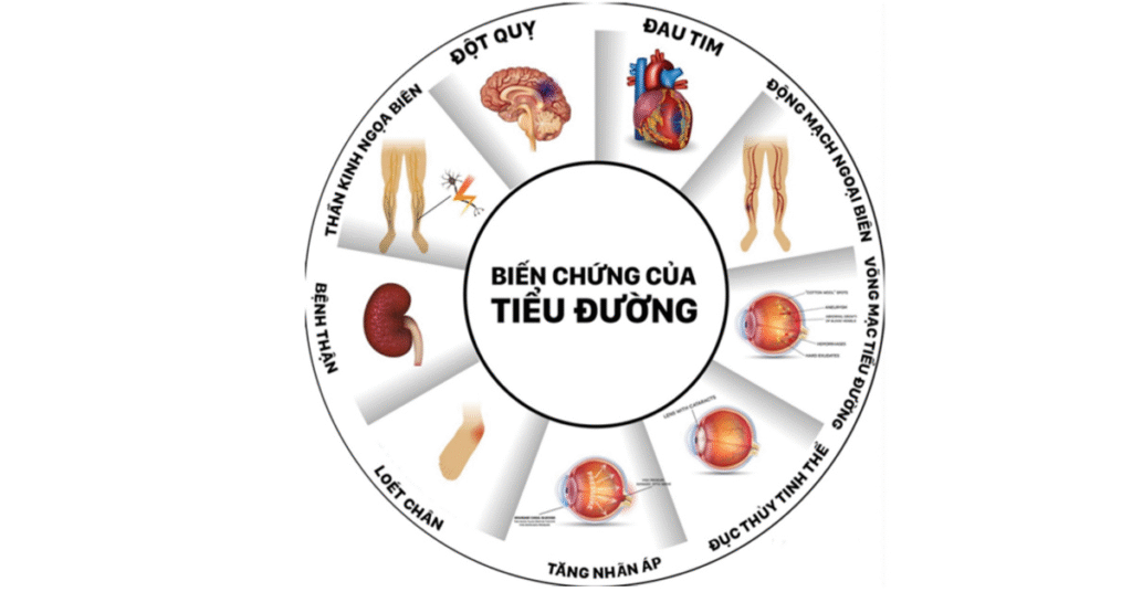 Bệnh tiểu đường